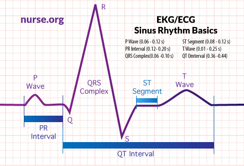 how to read EKG chart